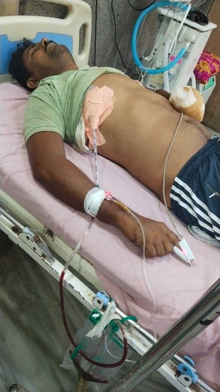 करेंट से झुलसा हुआ जिंदगी ओर मौत से जूझता युवक