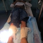 आरोपित पुलिस मुठभेड़ में घायल