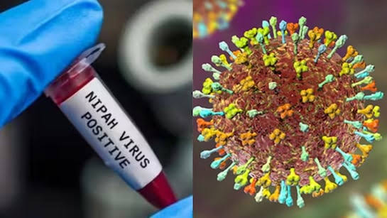 nipah