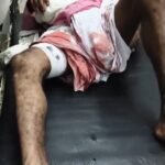 पंडित और बाराती को लगी गोली
