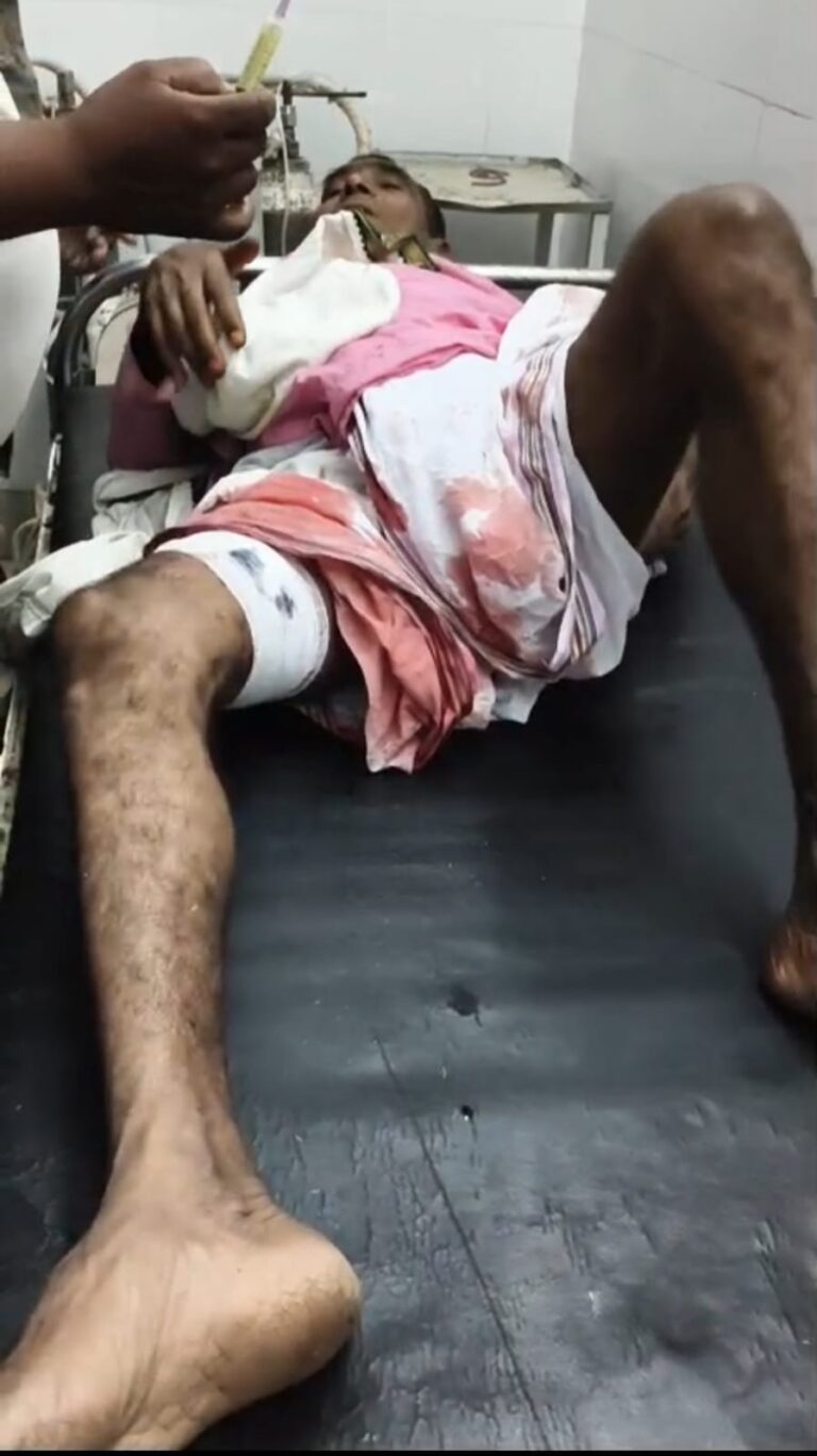 पंडित और बाराती को लगी गोली
